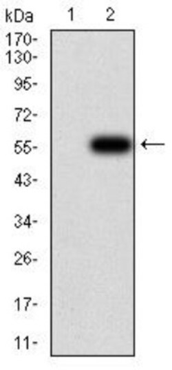 Complement Factor H-related 5/CFHR5 Antibody (3E1E10) - BSA Free, Novus